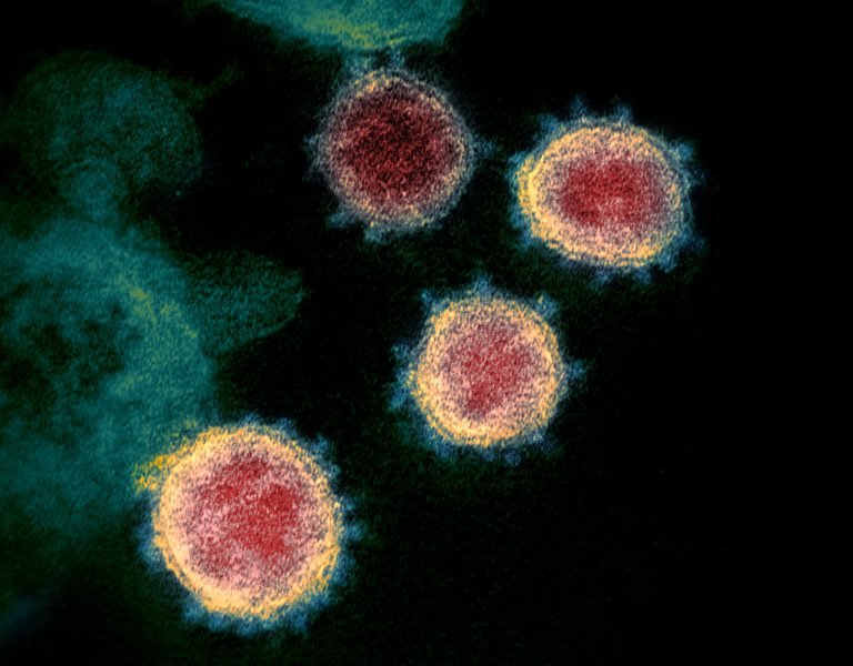 Novel_Coronavirus_SARS-CoV-2-Picture